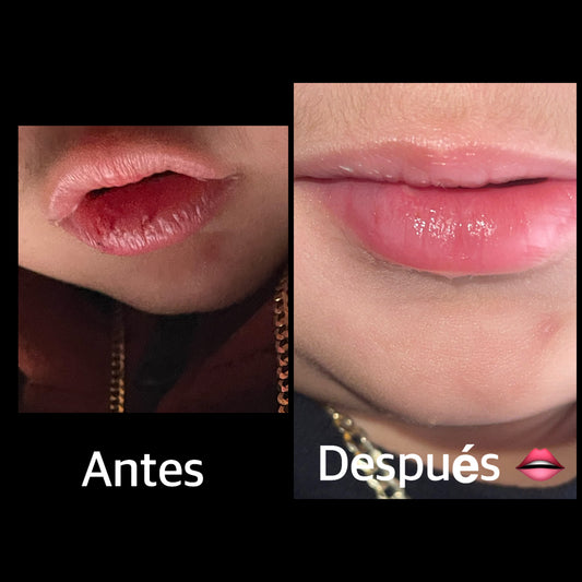 Antes & después utilizando nuestro bálsamo labial 